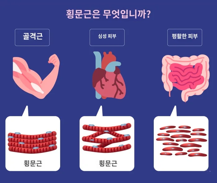 횡문근이란 무엇인가